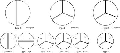 A Fluid–Structure Interaction Study of Different Bicuspid Aortic Valve Phenotypes Throughout the Cardiac Cycle